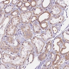 Anti-UACA Antibody