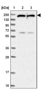 Lane 1: Marker [kDa] 250, 130, 95, 72, 55, 36, 28, 17, 10_br/_Lane 2: Human cell line RT-4_br/_Lane 3: Human cell line U-251MG sp