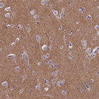 Immunohistochemical staining of human cerebral cortex shows moderate positivity in neuropil.