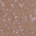 Immunohistochemical staining of human cerebral cortex shows moderate positivity in neuropil.
