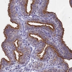 Immunohistochemical staining of human Fallopian tube shows strong positivity in apical membrane in glandular cells.