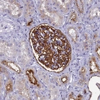 Immunohistochemical staining of human kidney shows strong membranous positivity in cells in glomeruli.