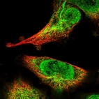 Immunofluorescent staining of human cell line U-251 MG shows localization to nucleus, intermediate filaments & vesicles.