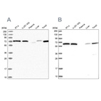 Anti-POLR3E Antibody