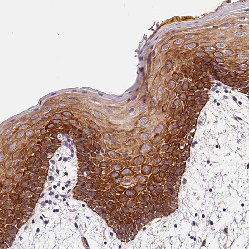 Anti-ARMC6 Antibody