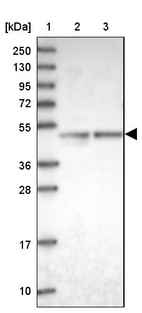 Lane 1: Marker [kDa] 250, 130, 95, 72, 55, 36, 28, 17, 10_br/_Lane 2: Human cell line RT-4_br/_Lane 3: Human cell line U-251MG sp