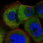 Immunofluorescent staining of human cell line A-431 shows localization to cytosol.
