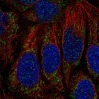 Immunofluorescent staining of human cell line CACO-2 shows localization to mitochondria.
