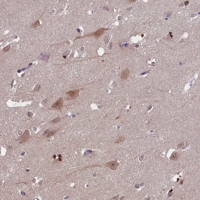 Anti-TBCB Antibody