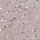 Anti-TBCB Antibody