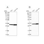 Western blot analysis using Anti-TBCB antibody HPA041428 (A) shows similar pattern to independent antibody HPA041722 (B).