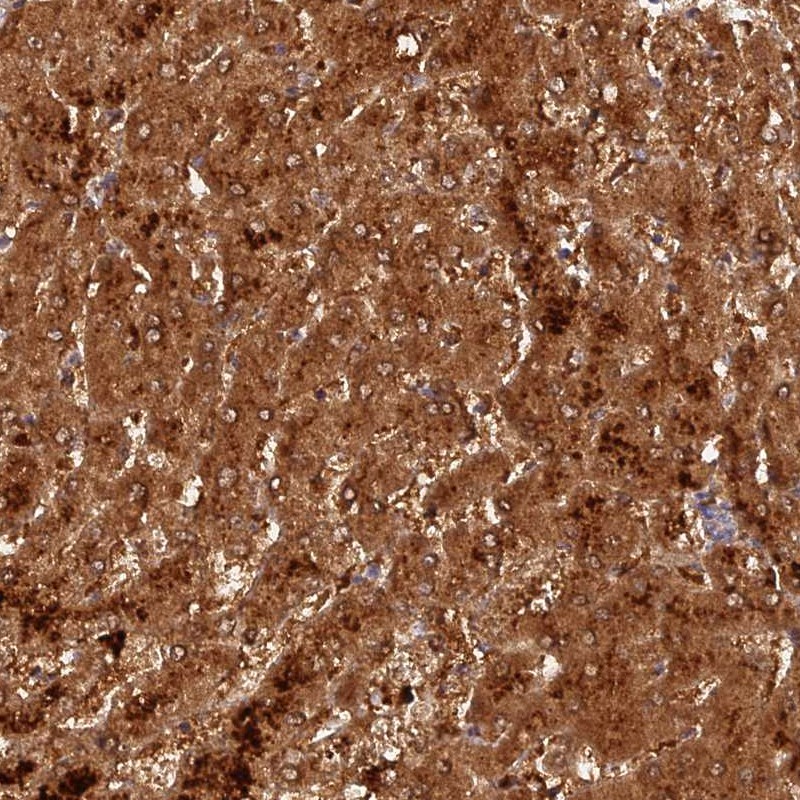 Anti-ACSM5 Antibody