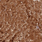 Anti-ACSM5 Antibody