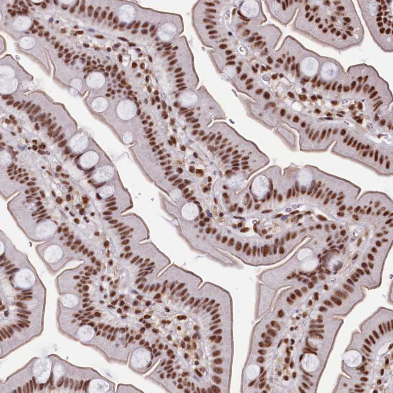Anti-SNRPD2 Antibody
