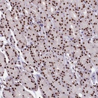 Anti-SNRPD2 Antibody