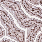 Anti-SNRPD2 Antibody