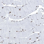 Immunohistochemical staining of human skeletal muscle shows strong nuclear positivity in myocytes.