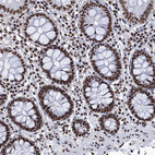 Immunohistochemical staining of human colon shows strong nuclear positivity in glandular cells and lymphoid cells.