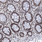 Immunohistochemical staining of human colon shows strong nuclear positivity in glandular cells and lymphoid cells.