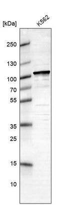 Western blot analysis in human cell line K562.