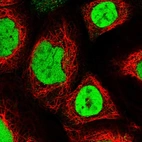 Immunofluorescent staining of human cell line A-431 shows localization to nucleoplasm.
