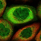 Immunofluorescent staining of human cell line A-431 shows localization to nucleoplasm & cytosol.