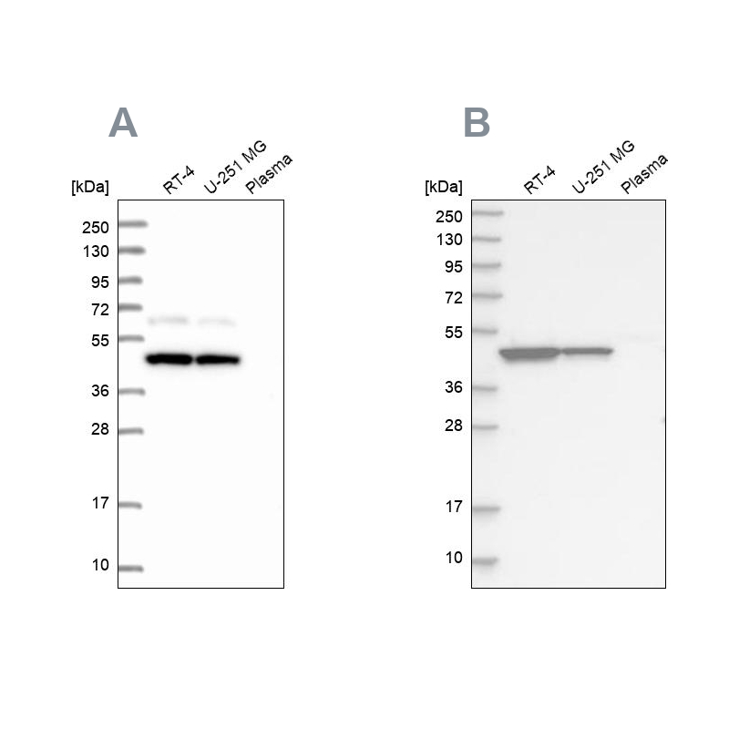 Anti-OLA1 Antibody