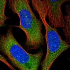 Immunofluorescent staining of human cell line U-2 OS shows localization to cytosol.