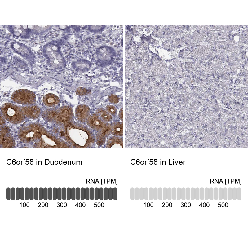 Anti-C6orf58 Antibody