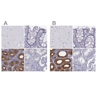 Immunohistochemical staining of human cerebral cortex, colon, duodenum and kidney using Anti-C6orf58 antibody HPA041449 (A) shows similar protein distribution across tissues to independent antibody HPA036263 (B).