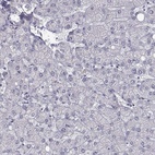 Anti-C6orf58 Antibody