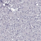 Immunohistochemical staining of human liver shows low expression as expected.