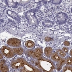 Immunohistochemical staining of human duodenum shows high expression.