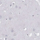 Immunohistochemical staining of human cerebral cortex using Anti-C6orf58 antibody HPA041449.