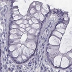 Immunohistochemical staining of human colon using Anti-C6orf58 antibody HPA041449.