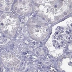 Immunohistochemical staining of human kidney using Anti-C6orf58 antibody HPA041449.