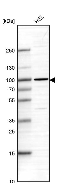 Anti-CNOT10 Antibody