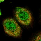 Immunofluorescent staining of human cell line A-431 shows localization to nucleoplasm & cytosol.