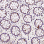 Immunohistochemical staining of human colon shows moderate to strong cytoplasmic positivity in lymphoid cells.