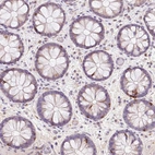 Immunohistochemical staining of human colon shows moderate to strong cytoplasmic positivity in lymphoid cells.