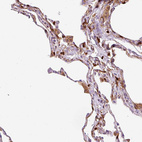 Immunohistochemical staining of human lung shows moderate membranous and cytoplasmic positivity in macrophages.
