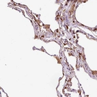 Immunohistochemical staining of human lung shows moderate membranous and cytoplasmic positivity in macrophages.