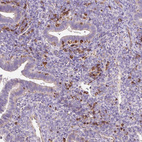 Immunohistochemical staining of human endometrium shows moderate to strong cytoplasmic positivity in lymphoid cells.