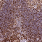 Immunohistochemical staining of human tonsil shows moderate to strong cytoplasmic positivity in lymphoid cells.