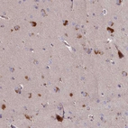 Immunohistochemical staining of human cerebral cortex shows strong granular cytoplasmic positivity in neurons.