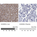Anti-ACADSB Antibody