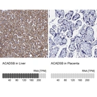 Anti-ACADSB Antibody
