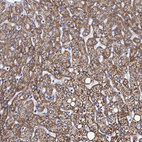 Immunohistochemical staining of human liver shows strong cytoplasmic granular positivity in hepatocytes.