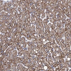 Immunohistochemical staining of human liver shows strong cytoplasmic granular positivity in hepatocytes.