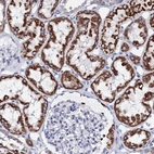 Immunohistochemical staining of human kidney shows strong cytoplasmic granular positivity in cells in tubules.